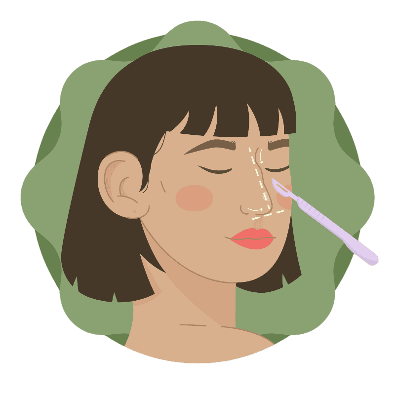 Rhinoplasty